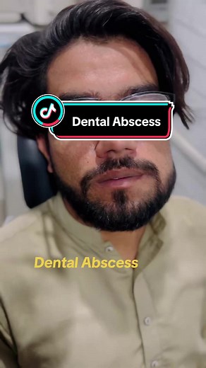 Dental abscess initial treatment #fyp #foryourpage #dentalcare #dentist #toothache