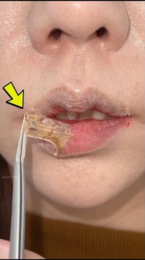 Stop peeling your lips 👄