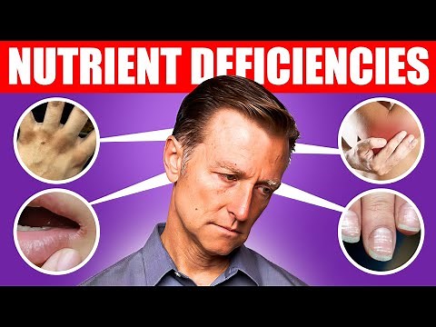 The 5 Nutrient Deficiencies Behind Depression