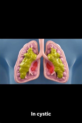 Gene Therapy Explained