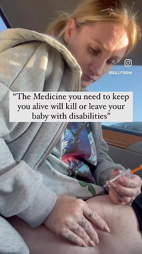 13M views · 313K reactions | The way people are shocked to see or...