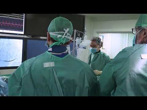 Sustitución valvular aórtica por cateterismo (TAVI)