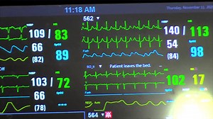 The number of COVID patients at San Juan Regional Medical Center continues to increase. We are calling on our entire community to please help reduce the enormous strain on our healthcare system and our caregivers. It will take all of us together to reduce the demand for precious healthcare resources. Please take steps to avoid preventable hospitalization. (Lynn Kern is an Occupational Therapy Assistant at SJRMC. Regrettably, her position was misidentified in this video) San Juan County NM City o