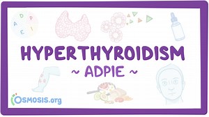 Hyperthyroidism: Nursing process (ADPIE): Video, Causes, & Meaning | Osmosis