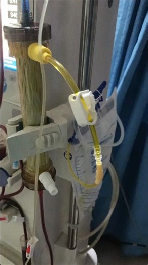 plasma pheresis #plasma #plasmapheresis