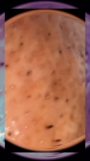 Effective Pore Extraction Techniques for Clear Skin