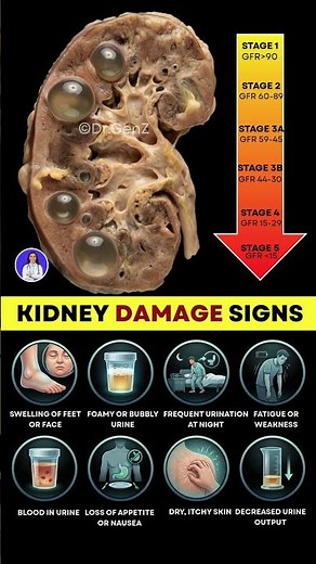 ⚠️ Warning Signs of Kidney Damage You Should Never Ignore