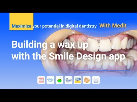 Building a Waxup with Smile Design app