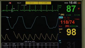 clip-17103388-ekg-respiration-oxygen-saturation-numbers-on-vital
