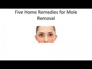 Five Home Remedies for Mole Removal | Natural Remedies That Remove Moles Safely and Fast