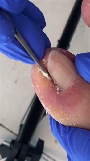 Easy Nail Cutting at Home | Clean & Perfect Trim! #nails #selfcare