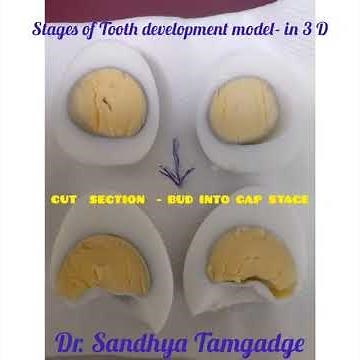 3D MODEL OF TOOTH DEVELOPMENT STAGES ( BUD &CAP)