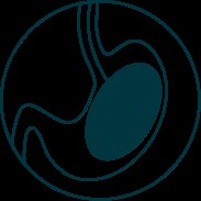 De doorslikbare maagballon in de strijd tegen overgewicht