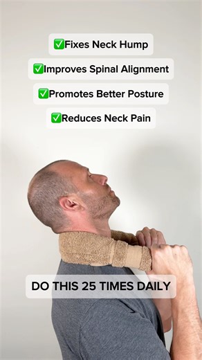 11K views · 136 reactions | Suffering from a neck hump and poor...