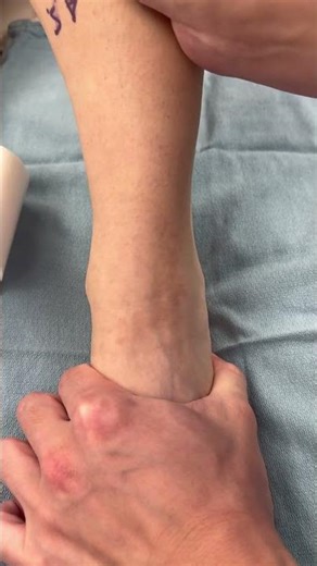 positive anterior drawer for ankle instability