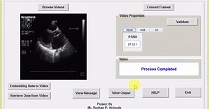 Video Steganography Matlab Code with Source Code || IEEE Based Project
