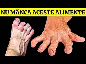 DACĂ AI ARTRITĂ NU MÂNCA NICIODATĂ ACESTE 7 ALIMENTE