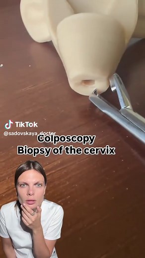 Understanding Colposcopy and Cervical Biopsy Procedures