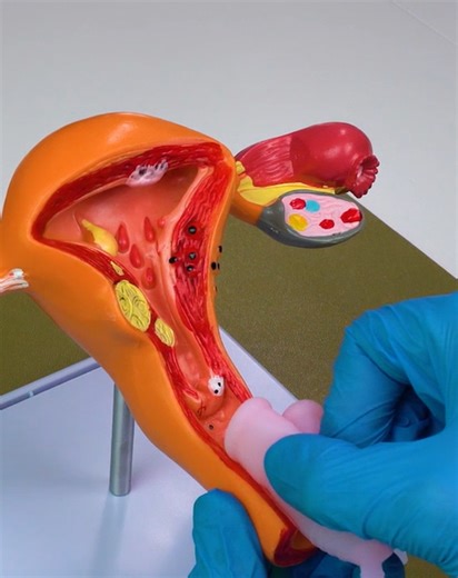 2.9M views · 2.8K reactions | Tampons vs Menstrual cup: Understand the red flag and green flag for intimate hygiene! | 5-Minute Crafts GIRLY | Facebook