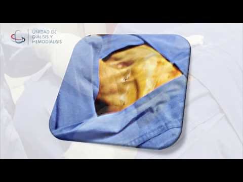 COLOCACIÓN DE CATÉTER PARA HEMODIÁLISIS GUIADA POR ULTRASONIDO