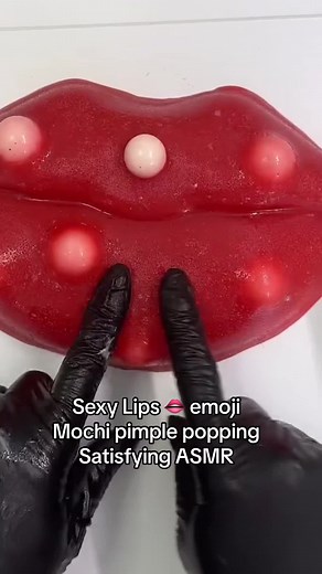 Sexy red lips pimple removal ! #CapCut #satisfying #longervideos #mochipimplepopping #pimplepopping #asmr #us ##visualasmr #viral #npc #fypシ゚viral🖤tiktok #foryou #lips #lipstreatment #lipspimples #sexylips #redlips #lipemoji