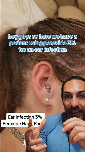 Peroxide for Earwax and Ear infections?
