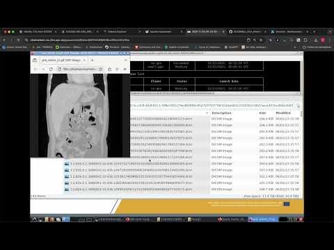 CT Slice thickness harmonization