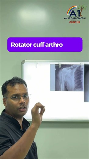 🥸X-Ray Challenge: Find the Shoulder Problem | Rotator cuff arthropathy