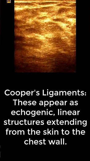 Understanding Normal Breast Ultrasound and Enlarged Right Axillary Lymph Nodes