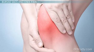 Bursae Knee Pain: Inflamed & Ruptured Bursa Sac