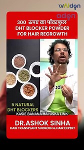 2K views · 29 reactions | Hair Loss Due to DHT? | Hair Growth | Hair Tips | Hair Care | Hair Expert | Waidon #viralshort | Waidon | Facebook