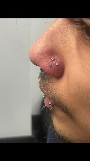 giving myself a triple nose pierving inspired by dabi from my hero 👹👹 • • @sinnerstattoo #fyp #dabi #myheroacademia #piercing #nosepiercing #foryou