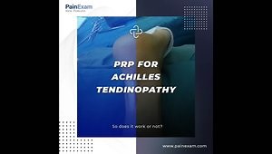 PRP for Achilles Tendinopathy