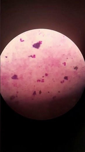 Malaria Parasite Under Microscope | Practical Demonstration (Thick & Thin Film)”