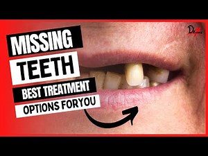 Best Solution for Missing Teeth