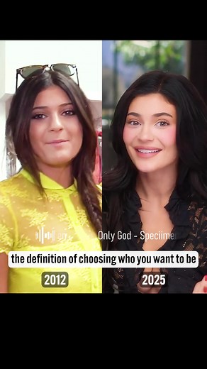 Kylie Jenner's Iconic Transformation Through the Years