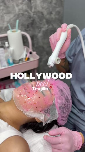Hollywood Peel: El Secreto para una Piel Radiante✨