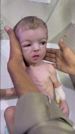 Adorable Baby Battling Many Health Problems – Full Pediatric Evaluation #baby #newborn #justborn