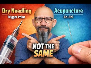 Dry Needling vs Acupuncture (The REAL Difference Most Get Wrong)