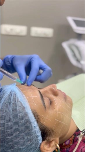 PDRN skin boosting injection #skinbrightening #cosmotology