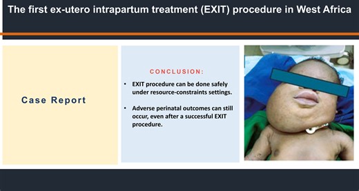 A Report on the First Ex‐Utero Intrapartum Treatment (EXIT) Procedure in West Africa