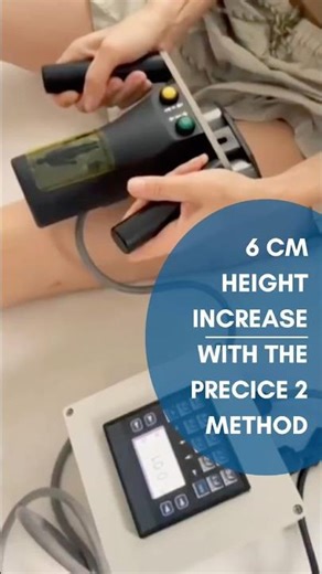 Grew 6 cm! How Does the PRECICE 2 Height Lengthening Process Work?