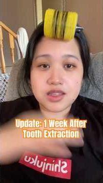 🦷 1 Week After My Tooth Extraction | Honest Update (Never Again 😩) #youtubeshorts