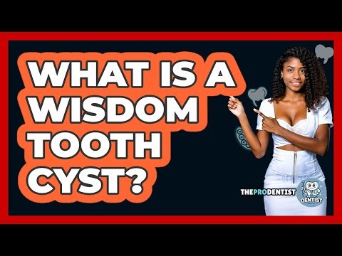 What Is a Wisdom Tooth Cyst?