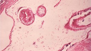 Fox or coyote tapeworms acting like ‘aggressive tumours’ threaten dogs, humans: expert | Globalnews.ca