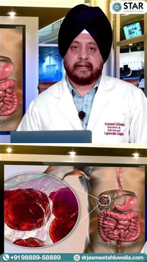 Liver Cyst, Liver me Ganth hone se kya hota hai | Cyst in Liver | लिवर में गांठ, फोड़ा या सिस्ट