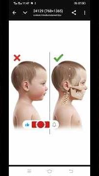 Baby Head Shape Correction Tips | Prevent Flat Head Syndrome Naturally”#shortsfeed #education