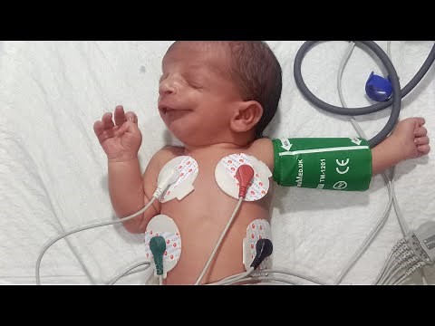 Nursery baby care is live!Newborn Baby ECG Procedure | Vitals & Blood Pressure Monitoring | NICU