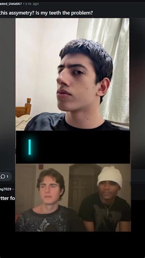 faceiq on Instagram: "Brutally Honest Face Ratings + Looksmaxxing Advice (ft. Kyan Stone) #looksmax #looksmaxxing #faceiq #facerating #qoves #plasticsurgery #jawsurgery #rhinoplasty"