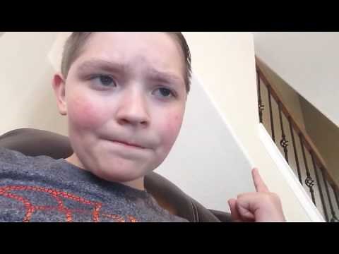 Cerebellar Hypoplasia